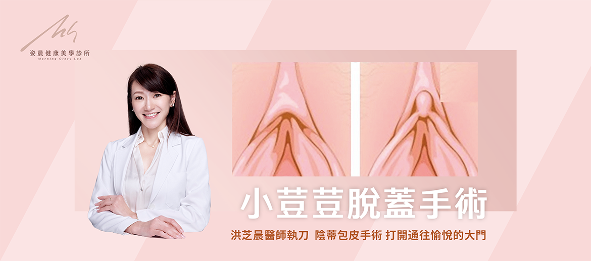 洪芝晨醫師 陰蒂包皮手術 姿晨健康美學診所院長