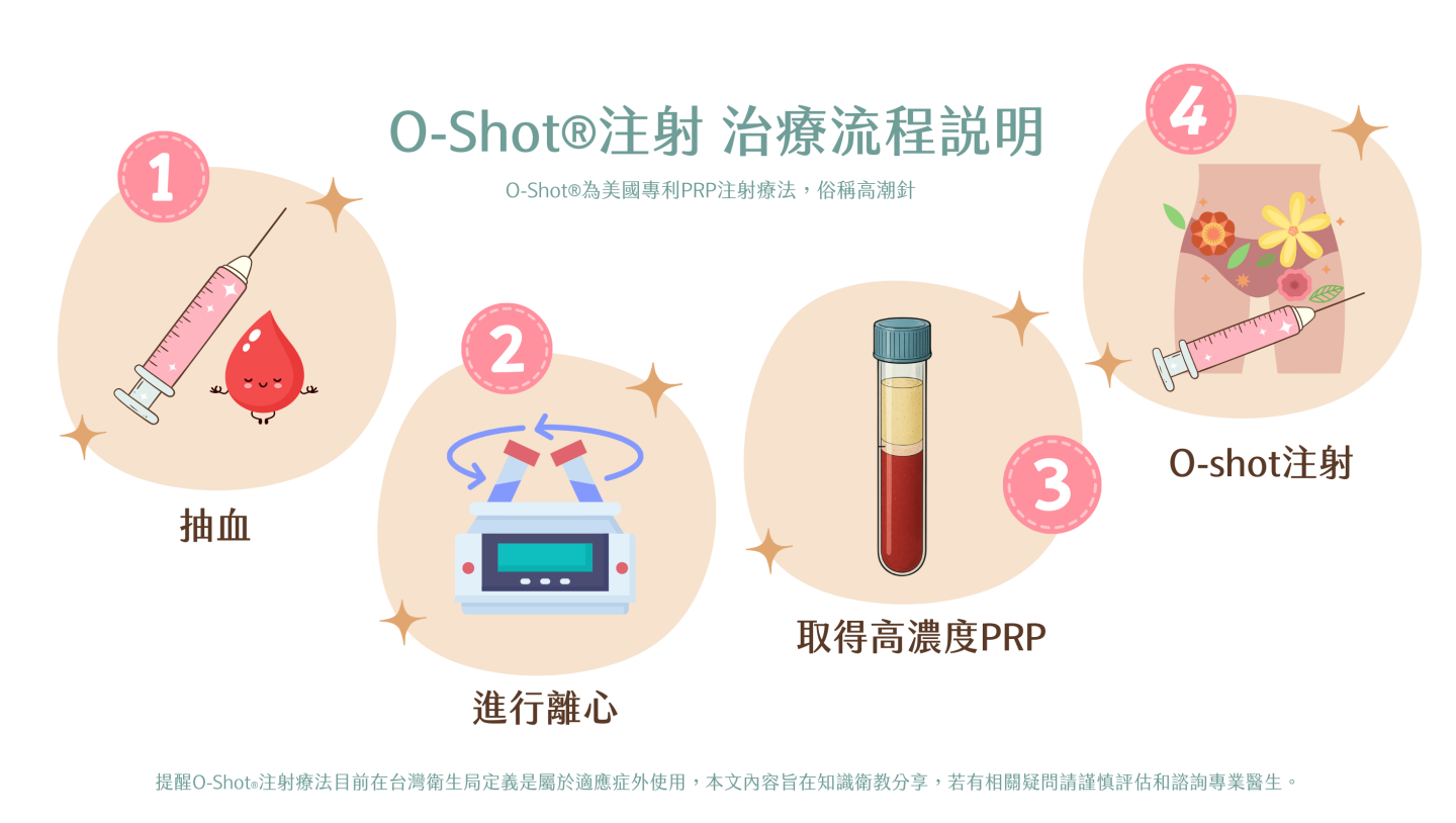 O-Shot® 高潮針注射治療流程說明
