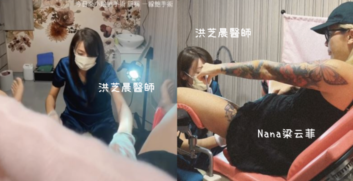 梁云菲做一線鮑手術「私處變粉紅」由洪芝晨醫師執刀